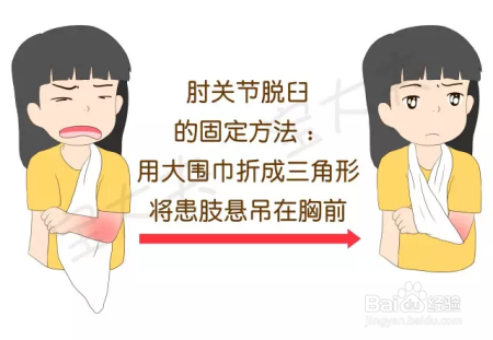 只牵了一下手,孩子手肘竟脱臼了!家长该怎么做