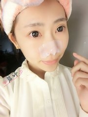 如何快速去黑头