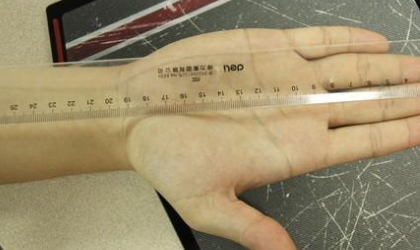 9毫米等于多少厘米