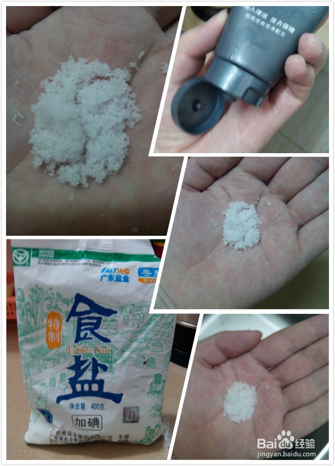 不花钱如何快速去掉脸上的油油和痘痘，控油祛痘