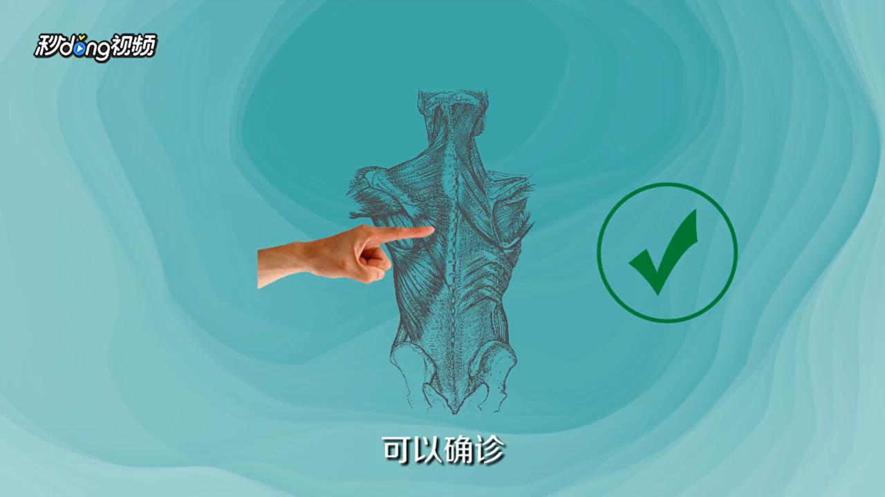 胳膊发麻怎么回事