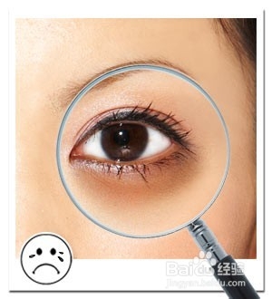 如何去掉烦人黑眼圈