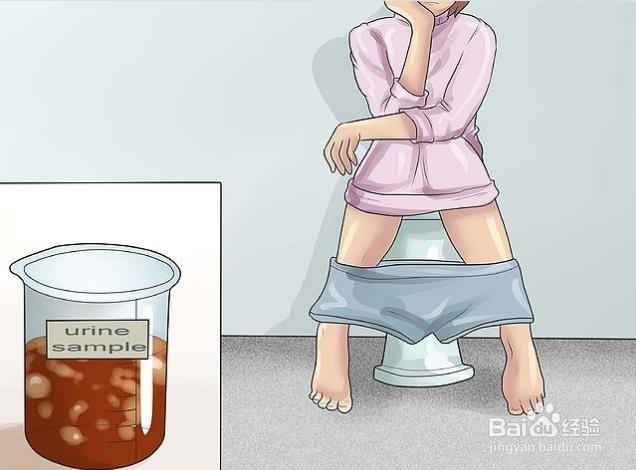 如何辨别肾衰竭，肾衰竭的症状具体有哪些？