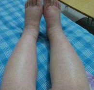 身体中哪些水中应该注意