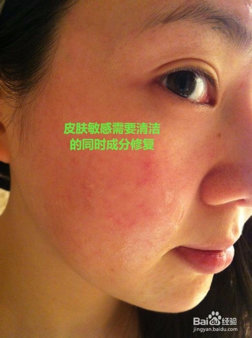 敏感肌肤如何选择洁肤水、卸妆水或者洁面产品?