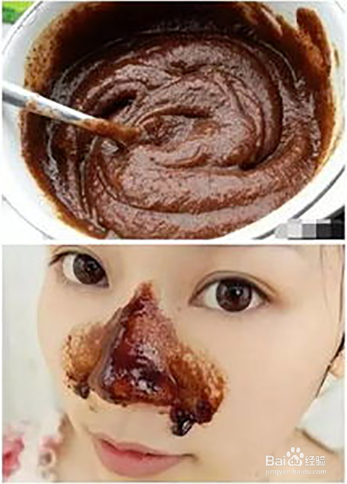 脸上雀斑怎么消除