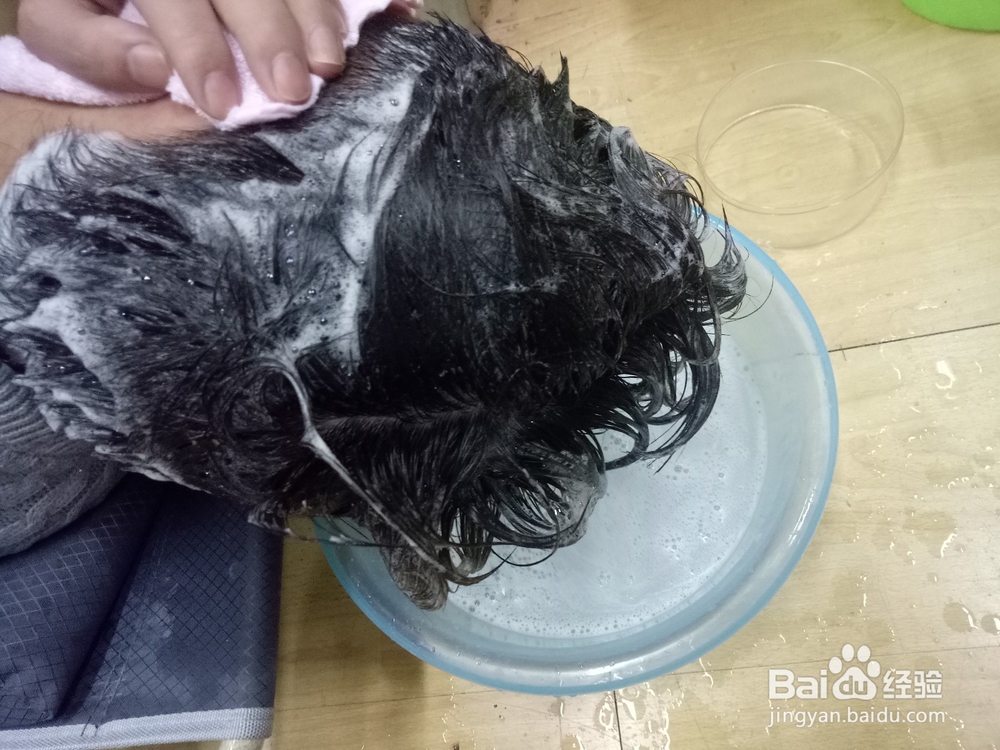 中耳炎患者手术后如何洗头发