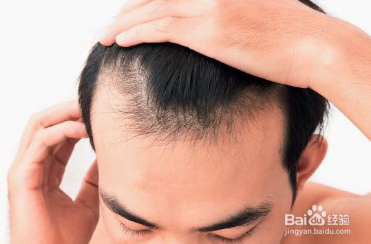 有这些问题说明缺乏维生素