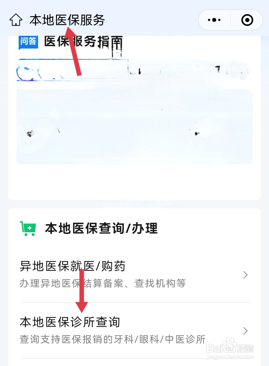 拔智齿怎么走医保
