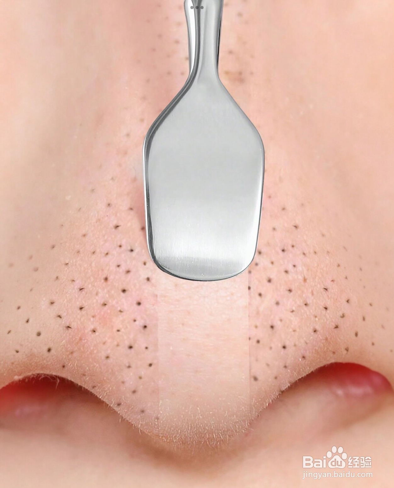 黑头粉刺很多怎么办?