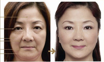 想拥有巴掌脸,一起学会以下几步骤脸操