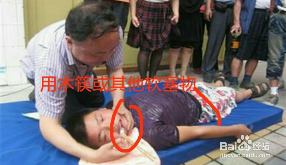 癫痫病人如何急救