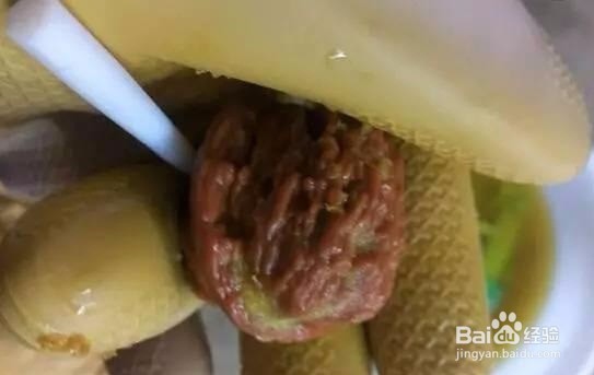 文玩核桃青皮怎么开