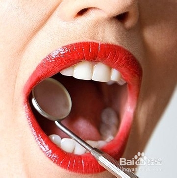 关于补牙的常见疑问解答