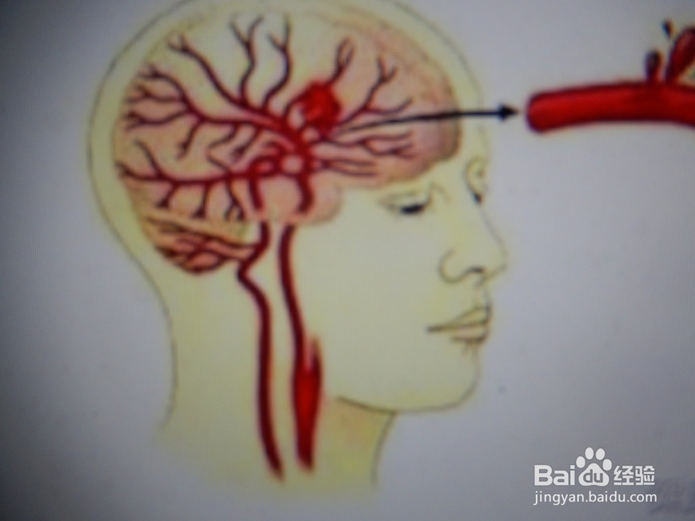 怎么知道坏脾气对人有多大的坏处?