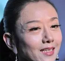 老年人“青筋”凸起什么缘故呢