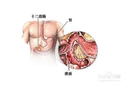 了解抽烟危害,关注身体健康