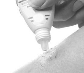 脸上起脓包怎么处理？能挤吗？