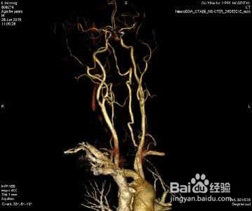 CTA认证的简介跟流程