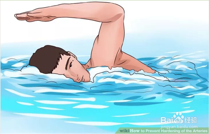 如何防止血管硬化