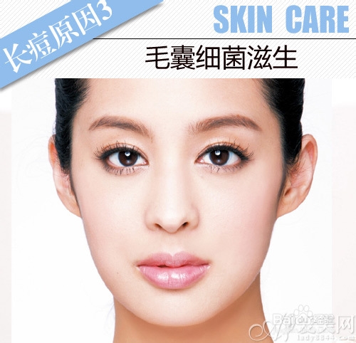 冬日祛痘只需4步