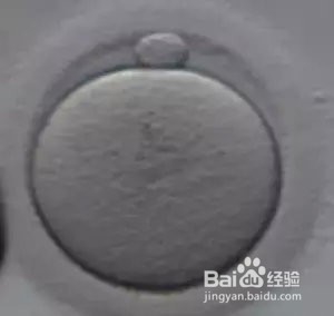 卵泡大小和试管婴儿结局有关吗？