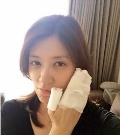 烫伤如何自行处理