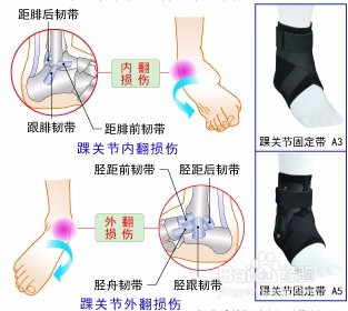 踝关节是哪个部位