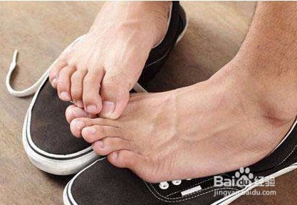 脚臭产生原因和预防脚臭的方法