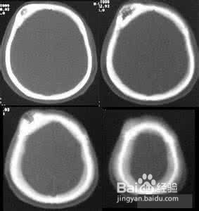 用构杞防病治病 及养生方法