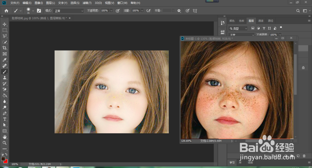 怎么去掉脸上的斑点