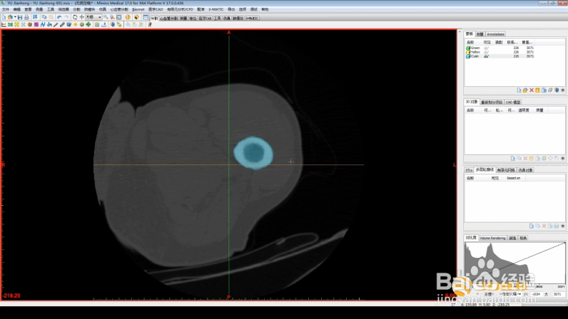 Mimics如何进行图像处理操作