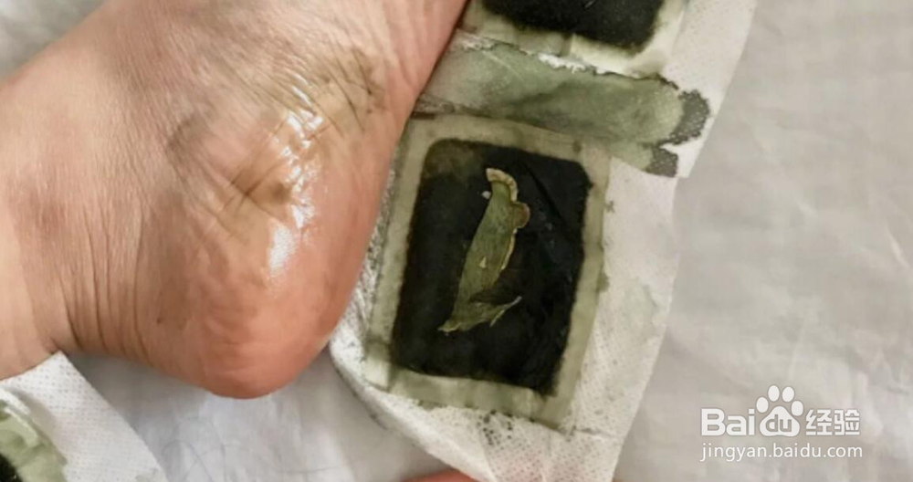 脚底贴中药贴真的有用吗