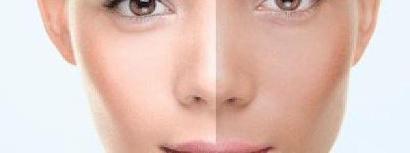 秋季皮肤经常性暗黄怎么美白