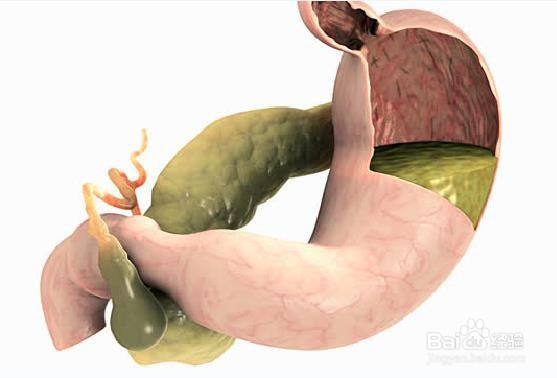 糖尿病会给身体造成哪些破坏
