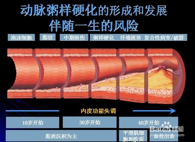 冠心病的小知识。（冠心病小常识）