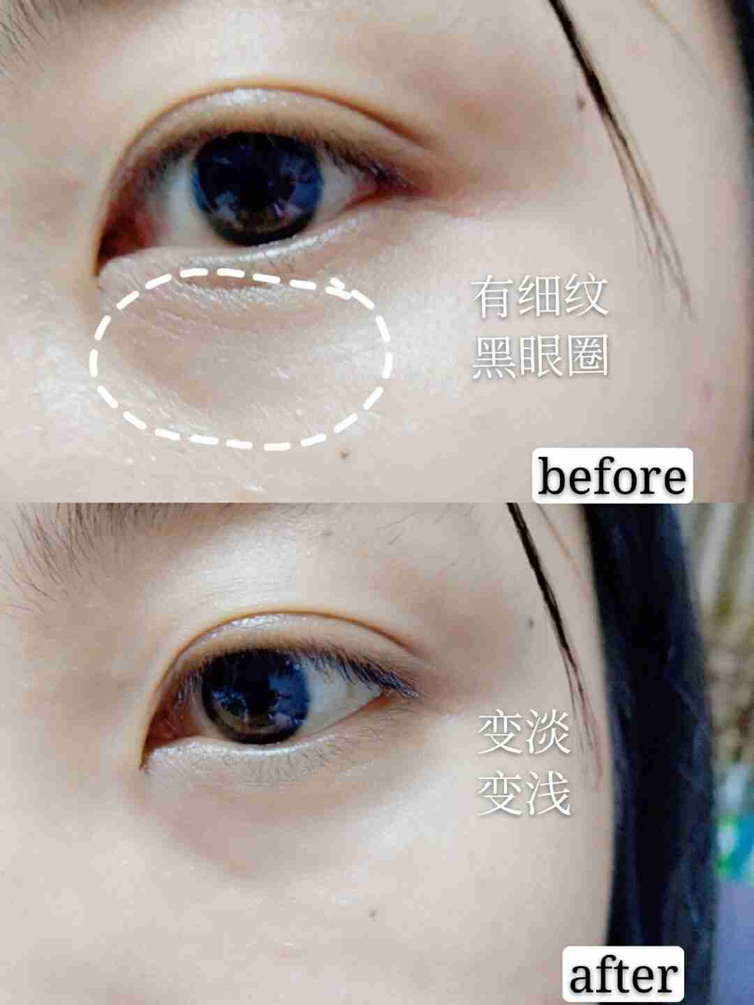 淡化细纹，这个抗初老眼霜用着超安心