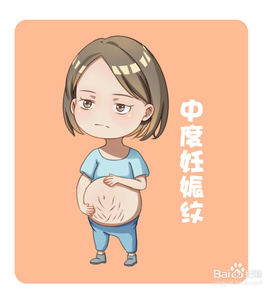 如何治疗妊娠纹