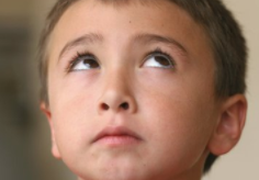 如何去除红血丝