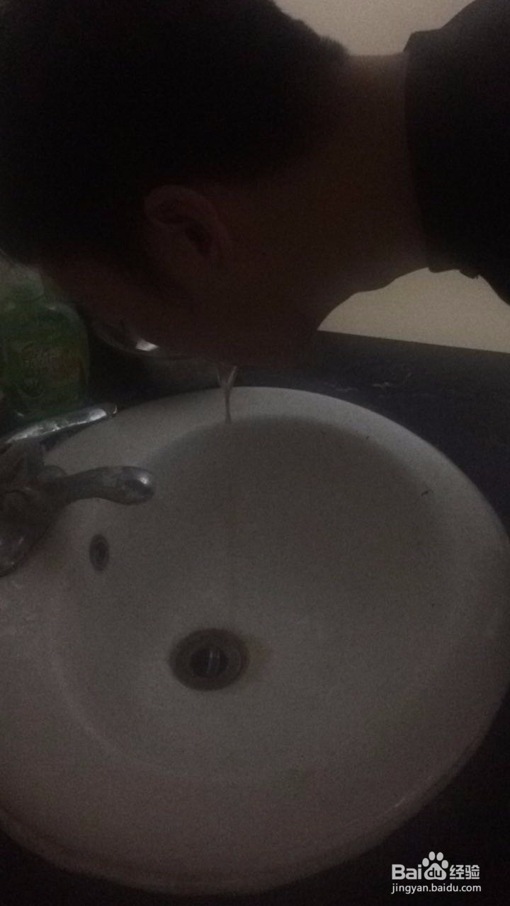 漱口水的正确使用方法及注意事项