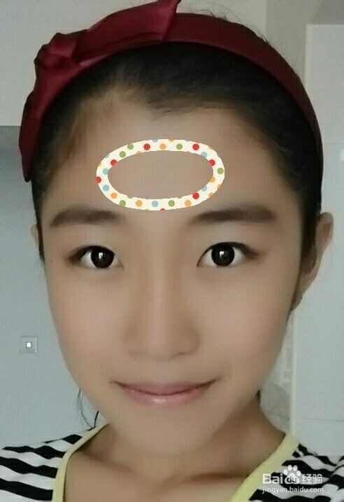 脸上痘痘的位置告诉你哪里出了问题