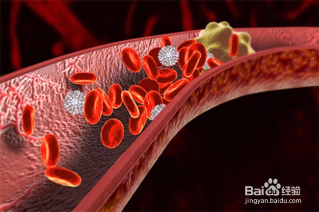 多吃这5种食物，可以有效清理血管堵塞。