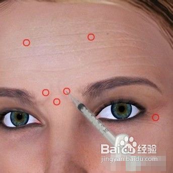 打瘦脸针除皱