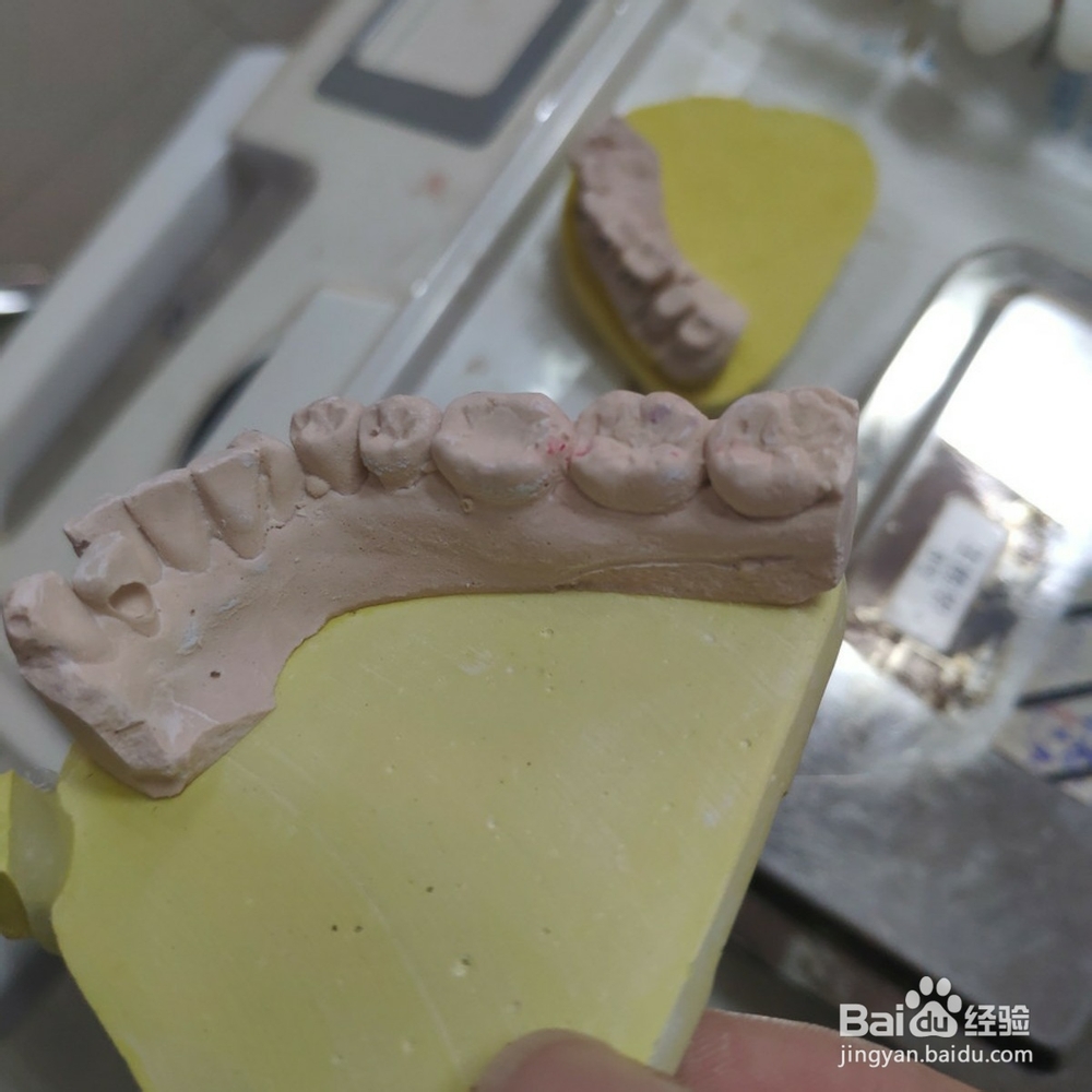 如何保护好我们的牙齿？