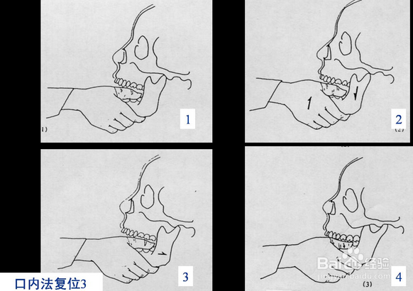 嚼槟榔到底有哪些坏处