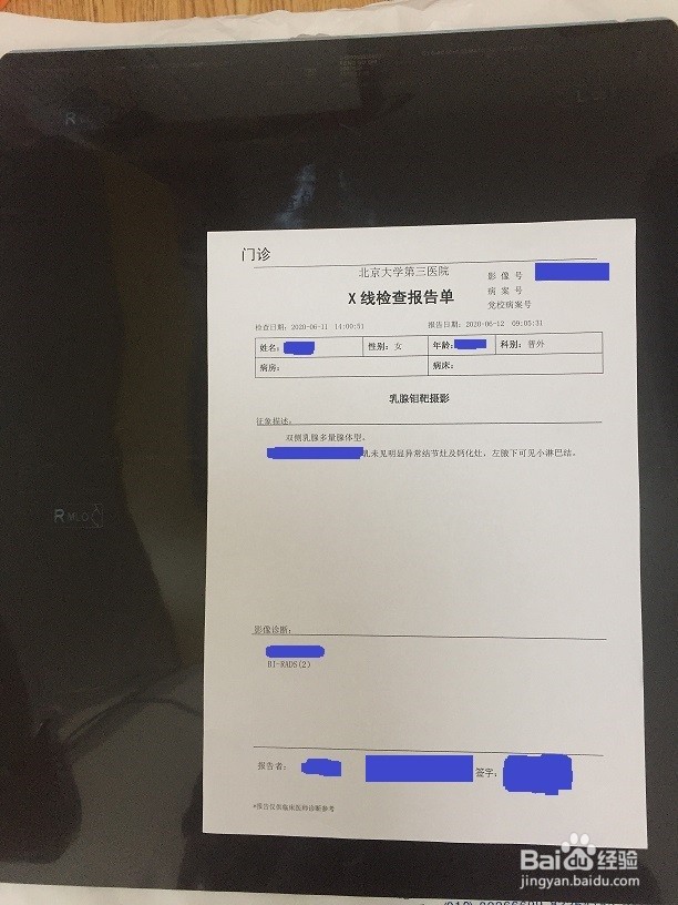 如何在北医三院检查乳腺疾病？