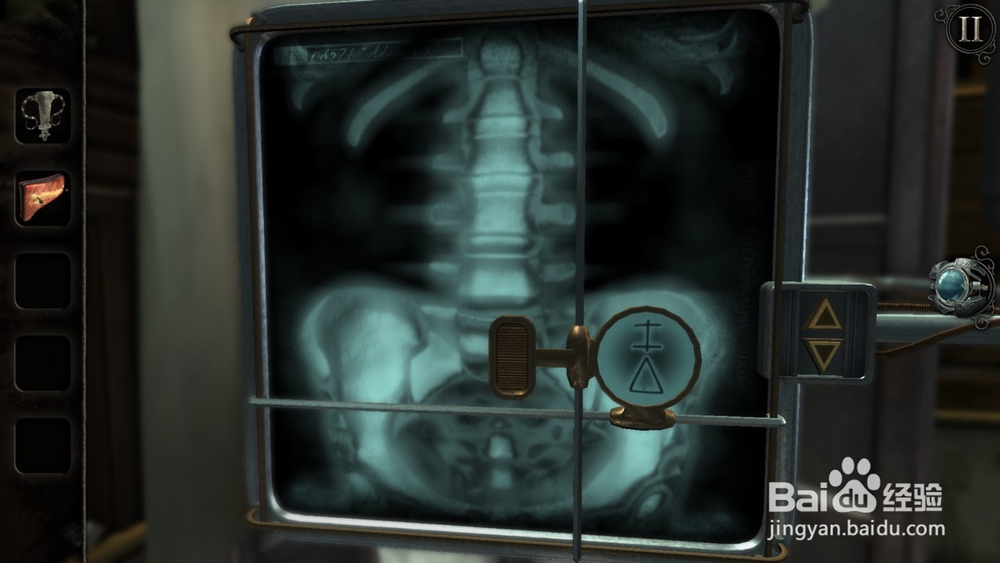 迷室往逝X光解谜攻略