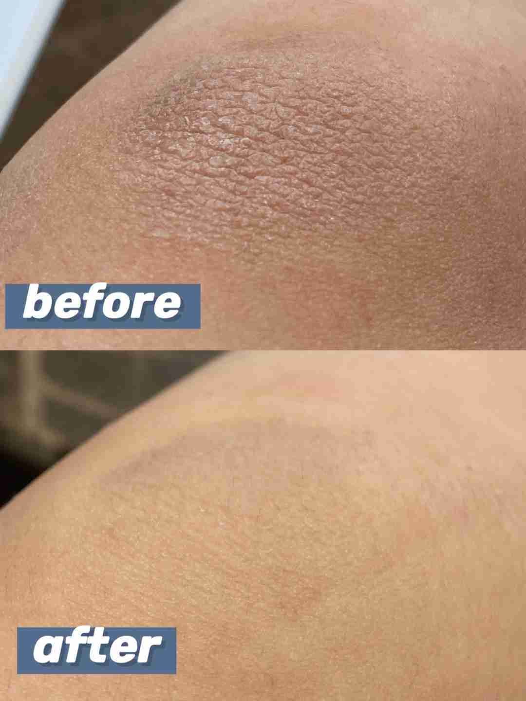 温和去角质,皮肤粗糙有它就够啦