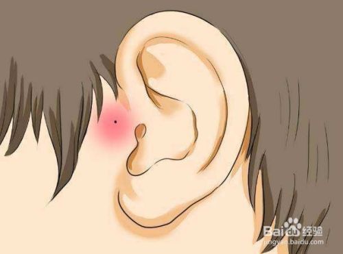 助听器验配小常识