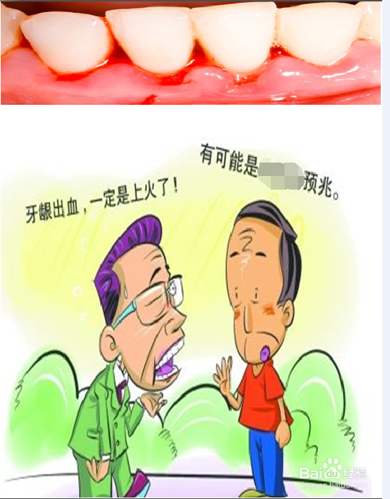 糖尿病的早期症状有哪些